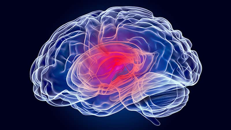 concussion Illustration of the brain representing concussion