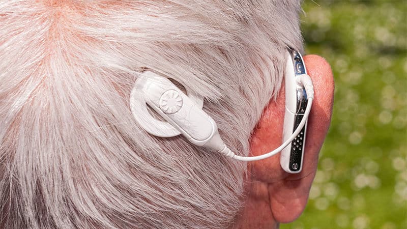 cochlear-implant Cochlear Implant